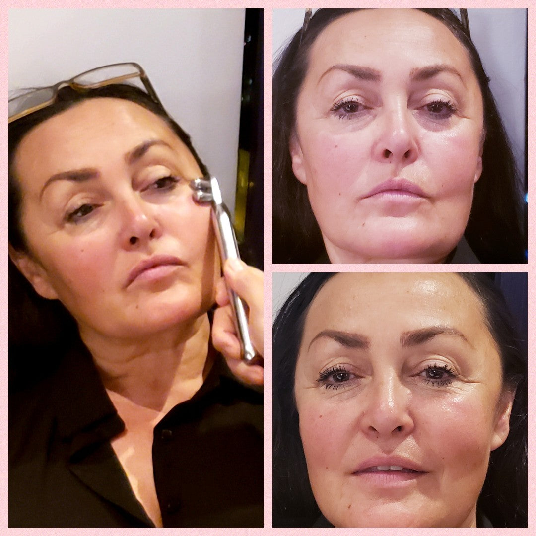 Microcurrent Face Roller